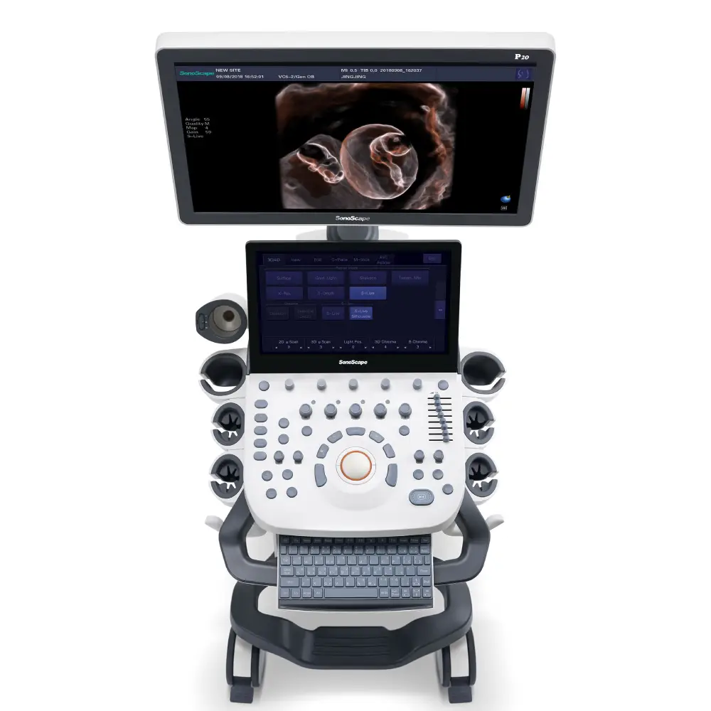 Ultrasound Machine with 2 probes and printer Ultrasound Machine with 2 probes and printer